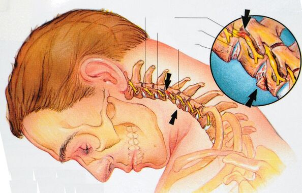 Ang istruktura sa cervical vertebrae